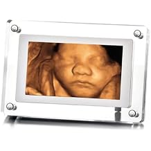 MBHB Digital Picture Frame, 7 Screen, Electronic Photo Frames for Ultrasound Replay, Re-chargeable 4GB Memory, USB Charging, Vertical/Horizontal Display, Upload Photos/Videos Easily