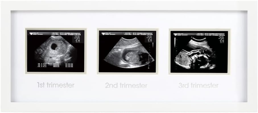 Pearhead Trimester Sonogram Picture Frame, Pregnancy Photo Milestone Wall Decor, Ultrasound Keepsake, Gender-Neutral Baby Nursery Décor, White