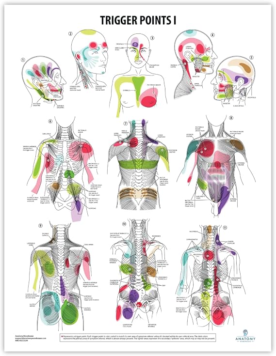Anatomy Lab Trigger Points I Laminated Poster | 17.3 x 22.5 Inch Detailed Anatomy & Physiology Chart of Muscle Trigger Points for Study, Classroom