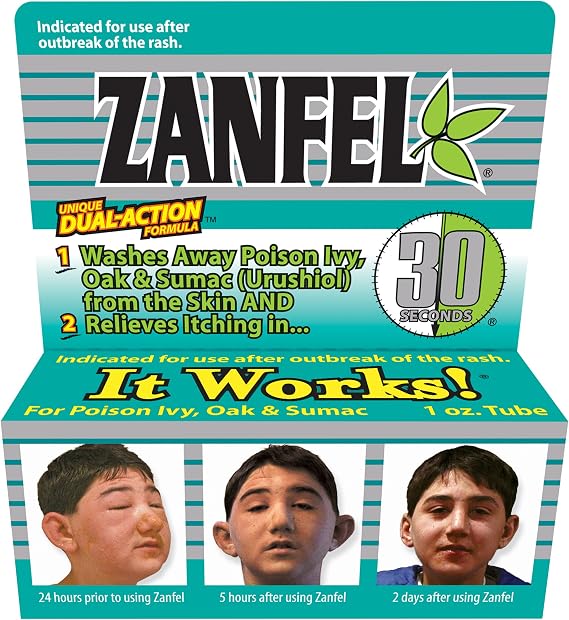 ZANFEL - Poison Ivy, Oak & Sumac Wash: Topical Solution for Poison Ivy, Poison Oak, and Sumac